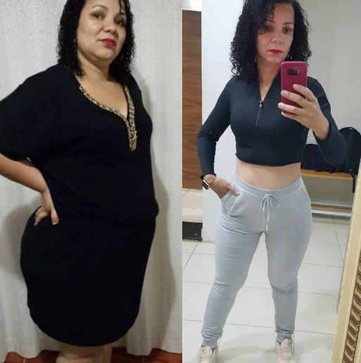 Antes e depois > Leandra publica fotos de como era, aos 136kg, e de como ficou - Arquivo Pessoal