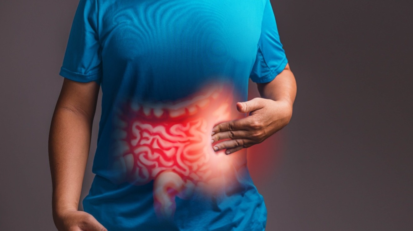 'Março Azul' é o mês da prevenção ao câncer de intestino - Reprodução/GastrosBA