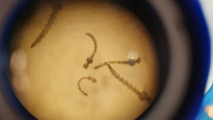 80% dos focos do mosquito são encontrados dentro das casas - Foto: PMCG