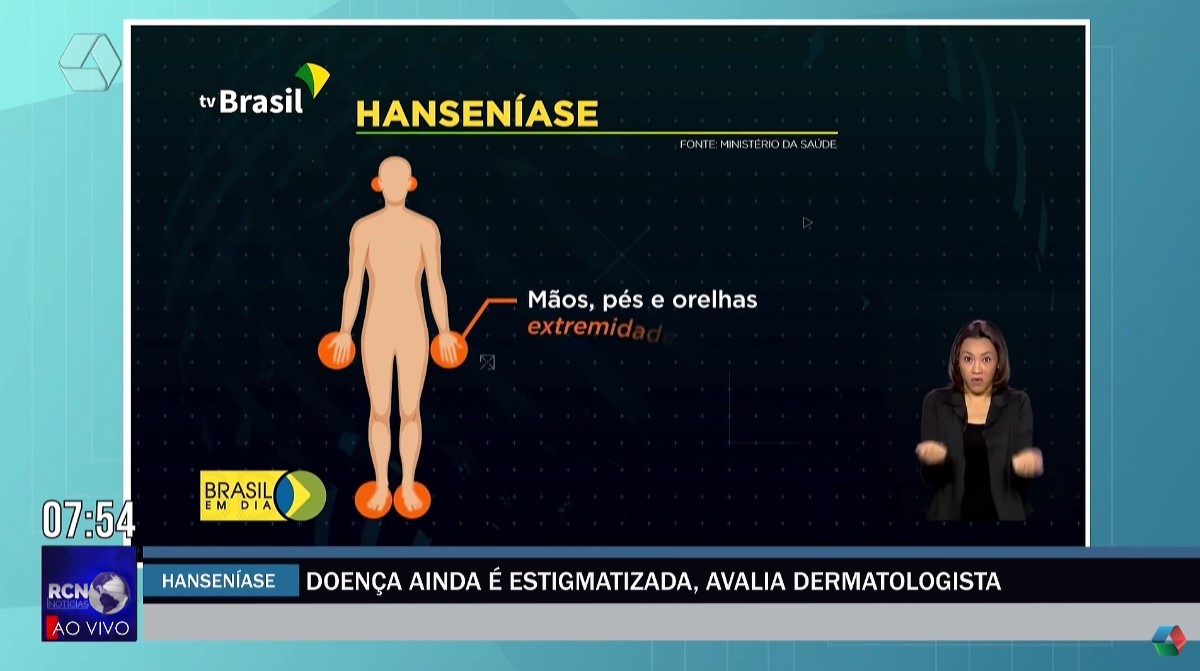 Hanseníase ainda é uma doença estigmatizada, avalia dermatologista