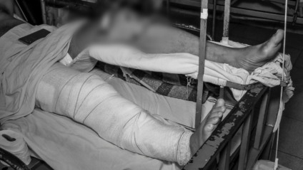 No ano passado, o pronto-socorro recebeu 2.998 pacientes nesse setor, sendo 2.334 homens e 664 mulheres - Foto: Divulgação Santa Casa No ano passado, o pronto-socorro recebeu 2.998 pacientes nesse setor, sendo 2.334 homens e 664 mulheres - Foto: Divulgação Santa Casa