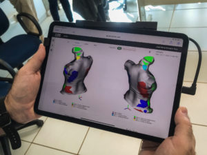 Universidade utiliza nova tecnologia do Canadá para detectar o problema de saúde - Foto: Álvaro Herculano/ UFMS