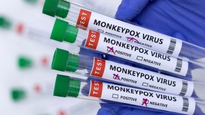 O diagnóstico da varíola dos macacos é realizado de forma laboratorial, por teste molecular ou sequenciamento genético - Foto: Divulgação Agência Brasil