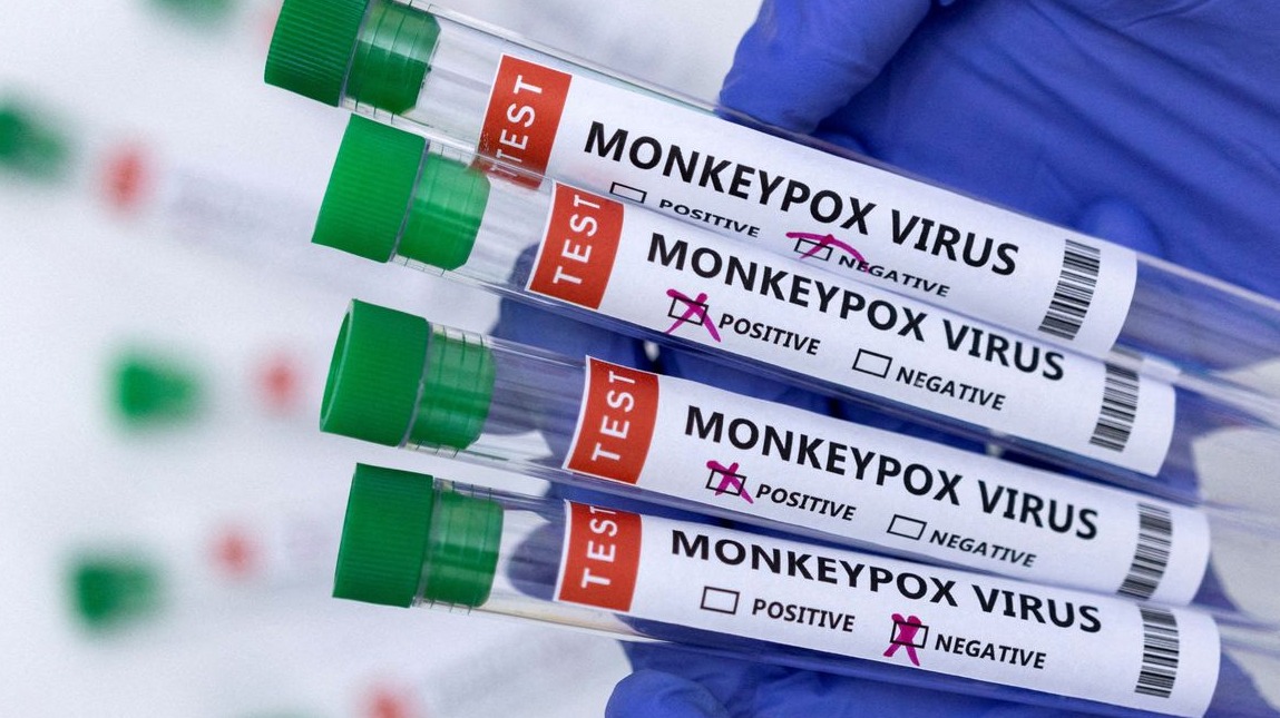 O diagnóstico da varíola dos macacos é realizado de forma laboratorial, por teste molecular ou sequenciamento genético - Foto: Divulgação Agência Brasil