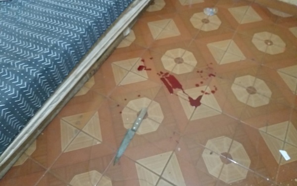 A autora negou ter ferido o ex-marido - 13º BPM Paranaíba/Reprodução A autora negou ter ferido o ex-marido - 13º BPM Paranaíba/Reprodução