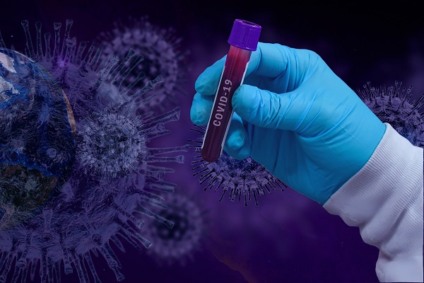Paranaíba soma 12 óbitos pela Covid-19, doença causada pelo novo coronavírus - Reprodução/Internet