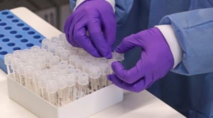 Três óbitos causados pela covid-19 foram registrados até o momento - Reprodução
