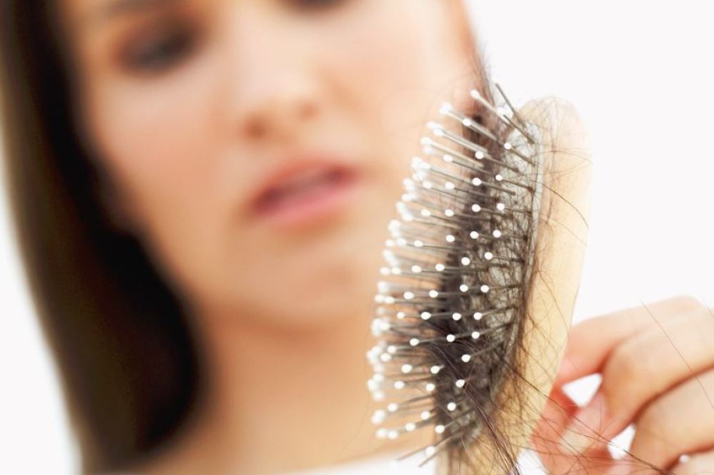 Queda de cabelo: fuja da calvície!