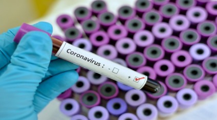 Boletim mostra que 187 pessoas aguardam resultado de seus testes - Arquivo/JP