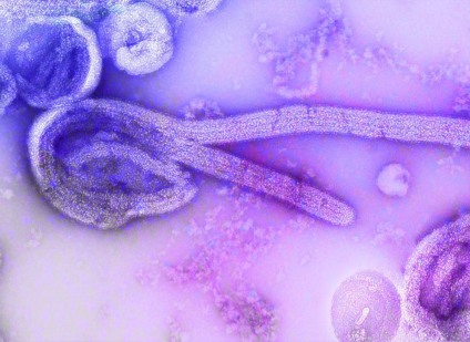 O vírus Chapare causa sintomas muito semelhantes ao Ebola - CDC/Unsplash