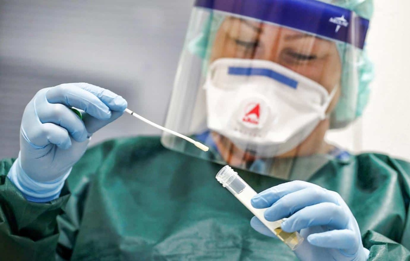 Resultado dos testes rápidos e RT-PCR são divulgados pelo sistema de informações online à pacientes com sintomas - Foto: Olhar Digital