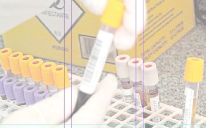 Levantamento mostra possibilidade de redução das contaminações no país - Arquivo/JP