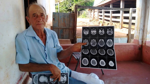 Dado como morto depois de acidente vascular cerebral, caseiro depende de medicação mensal - Leonardo Guimarães / JPNEWS