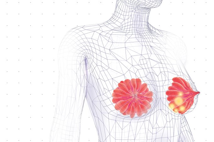 Exames periódicos evitam mortes por câncer de mama, diz estudo Exames periódicos evitam mortes por câncer de mama, diz estudo