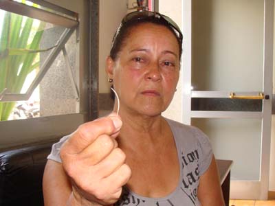 Vilma mostra o tamanho da espinha que precisou retirar sozinha, em casa -
