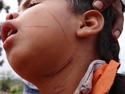 Os mais atingidos pela violência foram idosos e crianças -