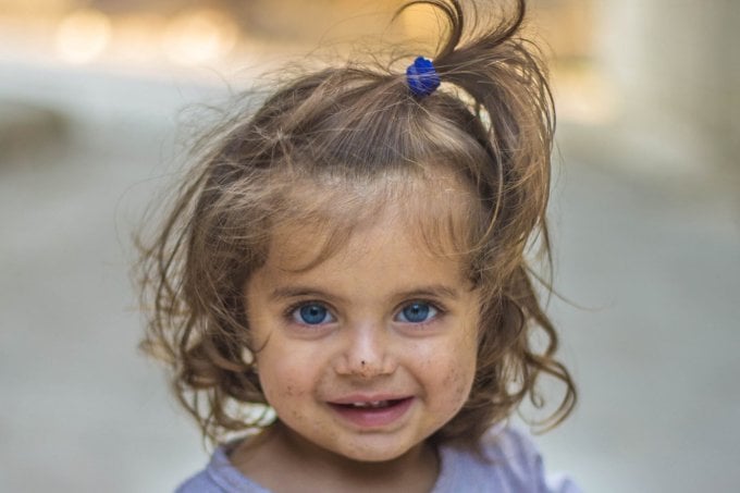 A história real da menina síria de foto viralizada na internet A história real da menina síria de foto viralizada na internet