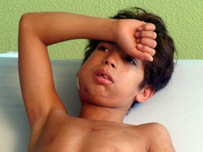 Lucas Ortiz de Morais tinha doença chamada -