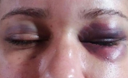 Mulher foi espancada dentro de casa pelo ex-namorado e sobreviveu - Reprodução