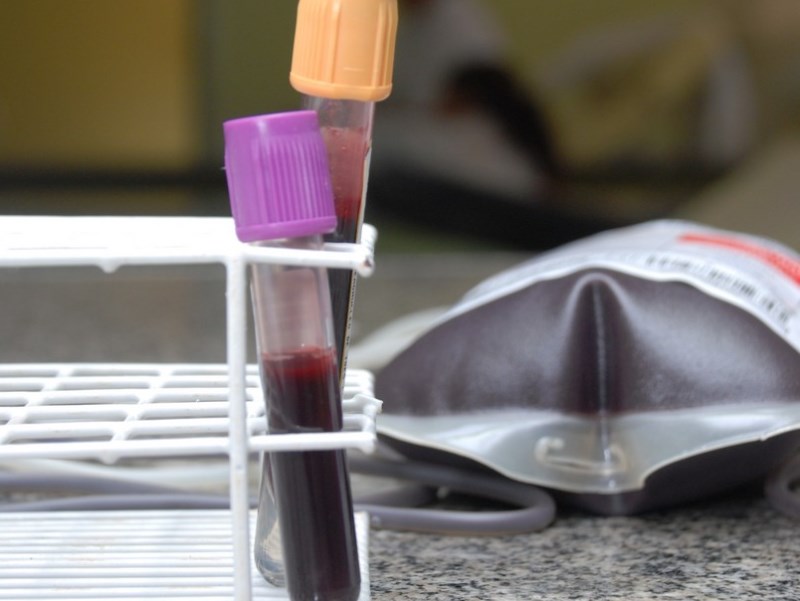 Doação de medula óssea começa pela coleta de 5 mililitros de sangue e a realização de exames clínicos - Arquivo/JP