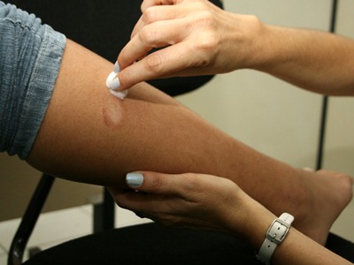 Tratamento pode durar de seis a 12 meses -