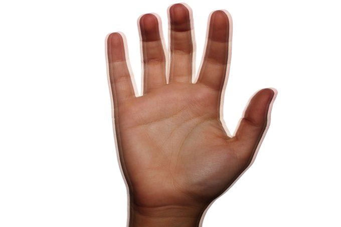 Como o Parkinson surge, afeta o corpo e causa tremores? Como o Parkinson surge, afeta o corpo e causa tremores?