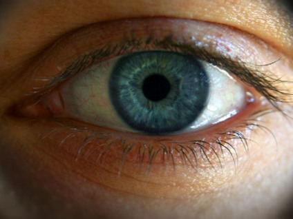 A cirurgia não obtém o resultado de imediato. O laser age na íris iniciando o processo que dura cerca de 30 dias até a tonalidade ficar totalmente azul - Luis Angel