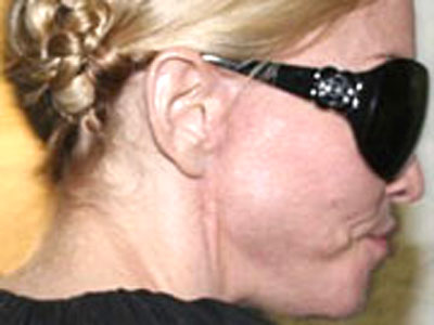 - -