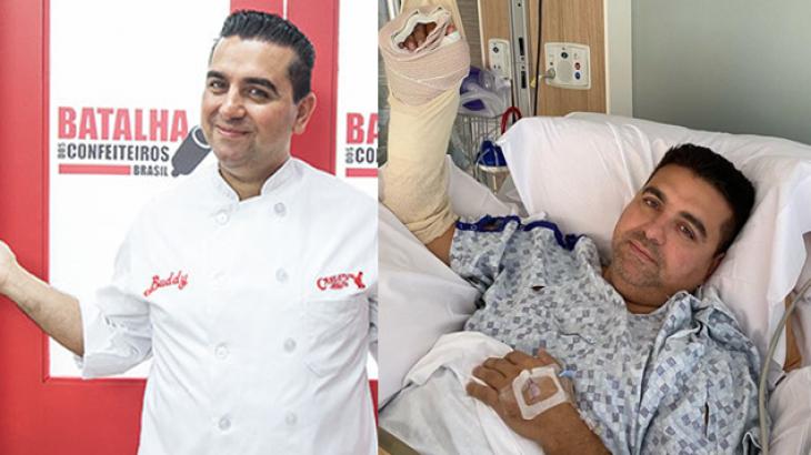 Buddy Valastro perde movimentos da mão em acidente