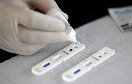 A distribuição dos testes para as unidades deverá ser feita de forma gradativa e os mesmos só serão realizados por pacientes que se encaixarem nos critérios pré-estabelecidos. - Divulgação
