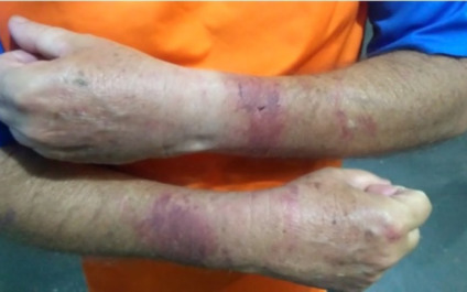 Homem teve braços e pernas amarrados e sofreu ferimentos - Divulgação Homem teve braços e pernas amarrados e sofreu ferimentos - Divulgação