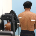 A hanseníase pode ser tratada com acompanhamento médico e uso adequado de remédios - Foto: Reprodução SES