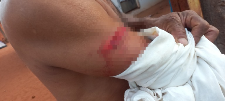 Briga termina com homem ferido no Vila Piloto