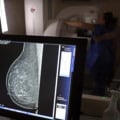 O índice de realização do exame em âmbito estadual e nacional estão abaixo do recomendado pela OMS - Foto: Portal Gov BR