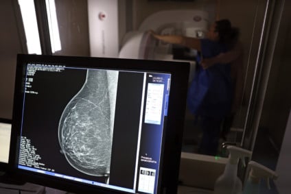 O índice de realização do exame em âmbito estadual e nacional estão abaixo do recomendado pela OMS - Foto: Portal Gov BR