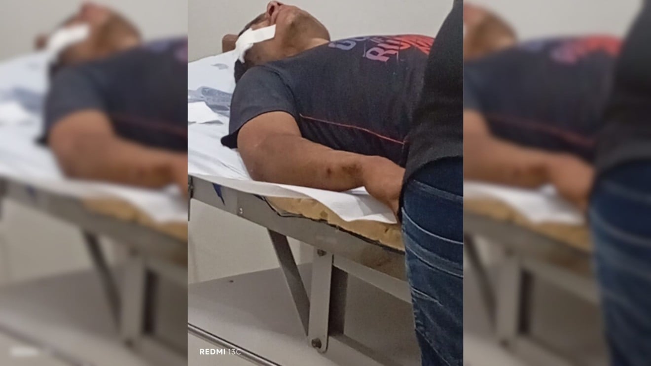 Depois de tentar furtar objetos de trabalhadores suspeito foi pego agredido e levado pra UPA. Foto: Divulgação.