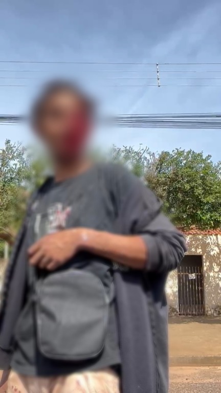 Homem é esfaqueado no olho no bairro Guanabara Sul