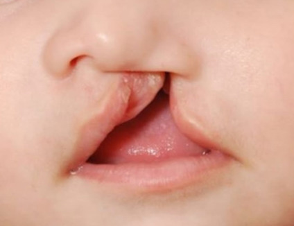 Exame deve ser feito nas primeiras 48 horas de vida do bebê - Foto: Reprodução/ Cláudio Lemos