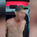 Homem foi encontrado ferido pela GCM (Foto: Reprodução/ GCM)