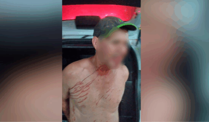Homem foi encontrado ferido pela GCM (Foto: Reprodução/ GCM)