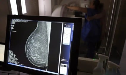 Ação faz parte da programação da campanha Outubro Rosa / Foto: Reprodução/José Cruz/Agência Brasil