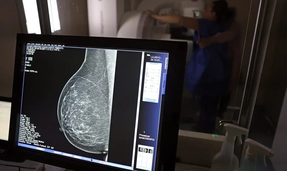 Ação faz parte da programação da campanha Outubro Rosa / Foto: Reprodução/José Cruz/Agência Brasil