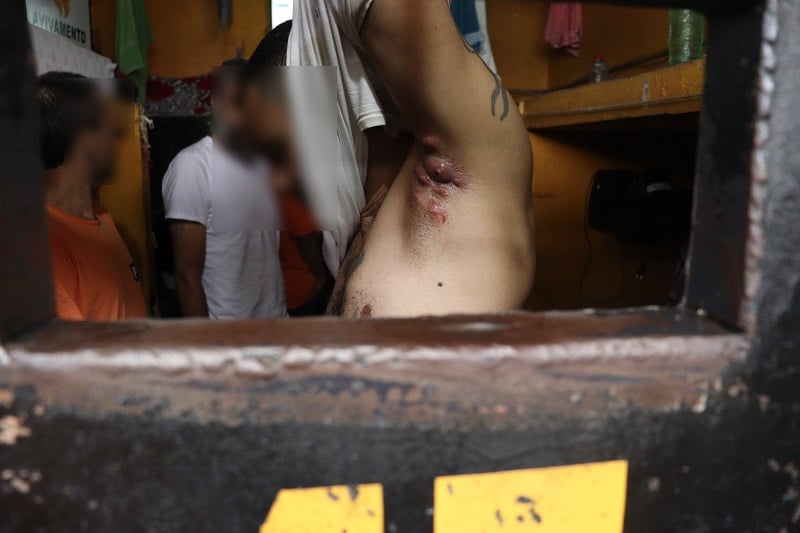 Proliferação de furunculose explícita em interno da PED - Foto: Nuspen/DPMS
