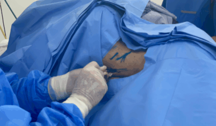 Cirurgia foi realizada no Hospital Militar de Área de Campo Grande Foto: CMO