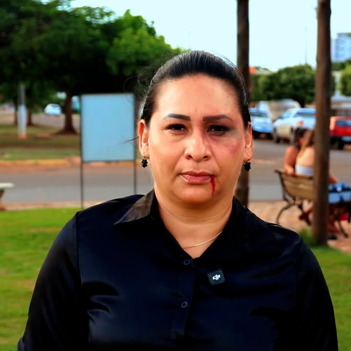 Primeira-dama simula hematomas no rosto em vídeo para conscientizar sobre violência contra a mulher em MS